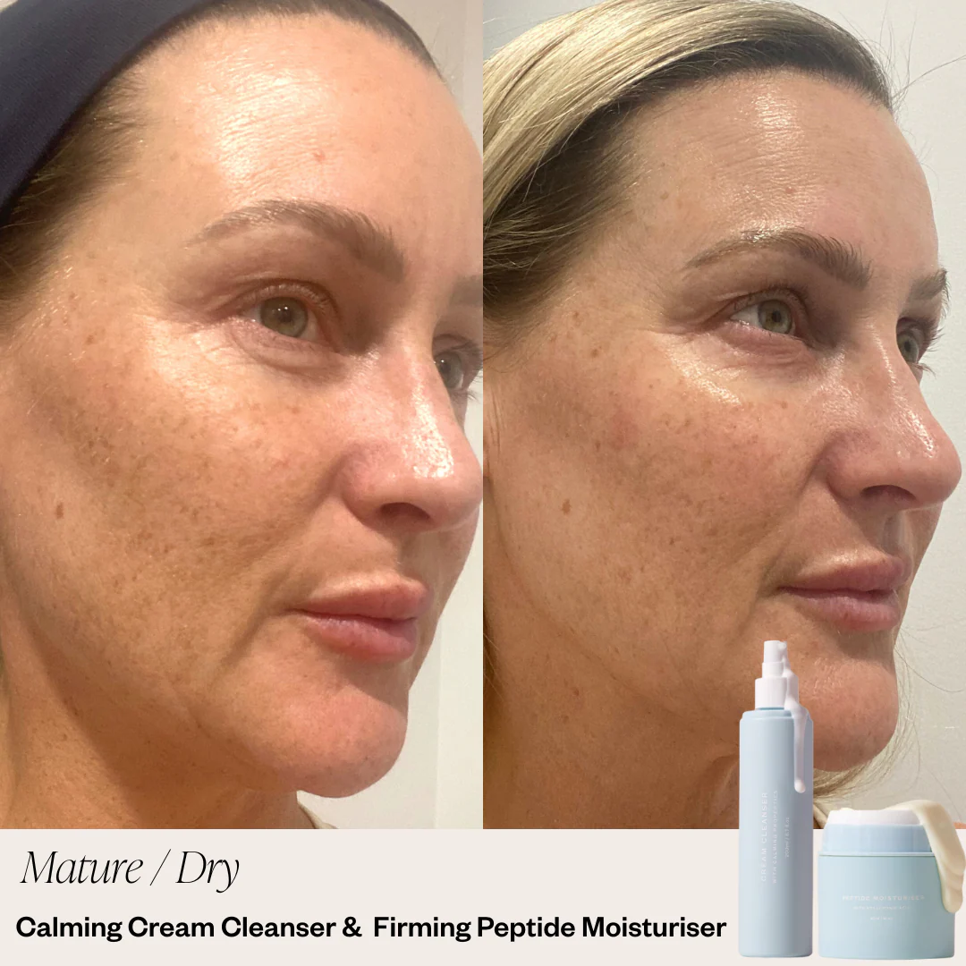 2 Step Skincare System - Image 4