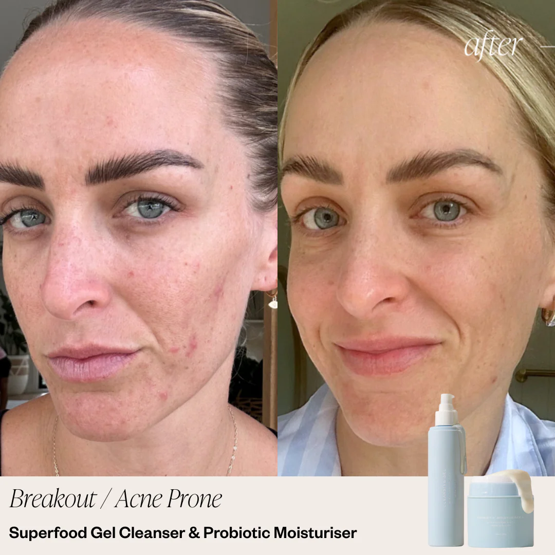 2 Step Skincare System - Image 6