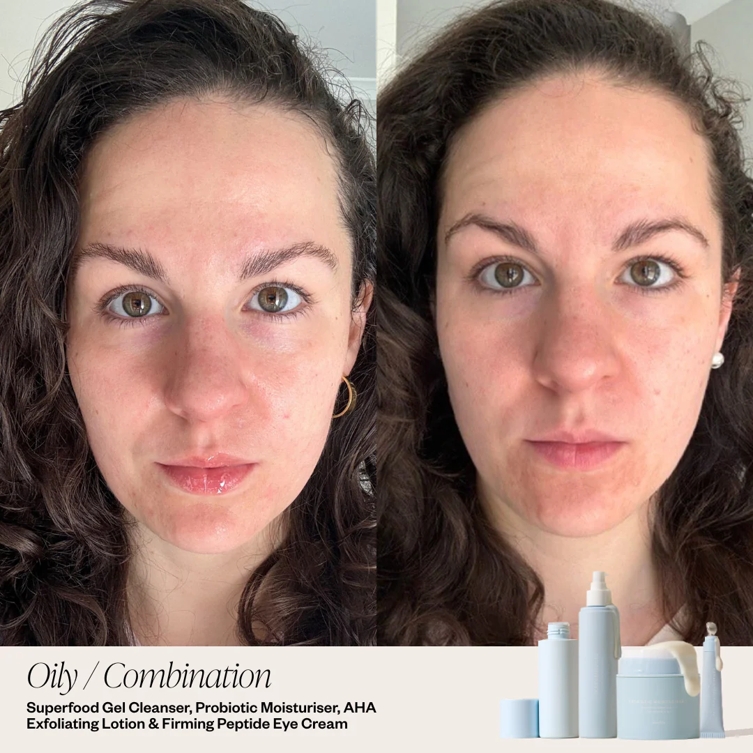 4 Step Skincare System - Image 3