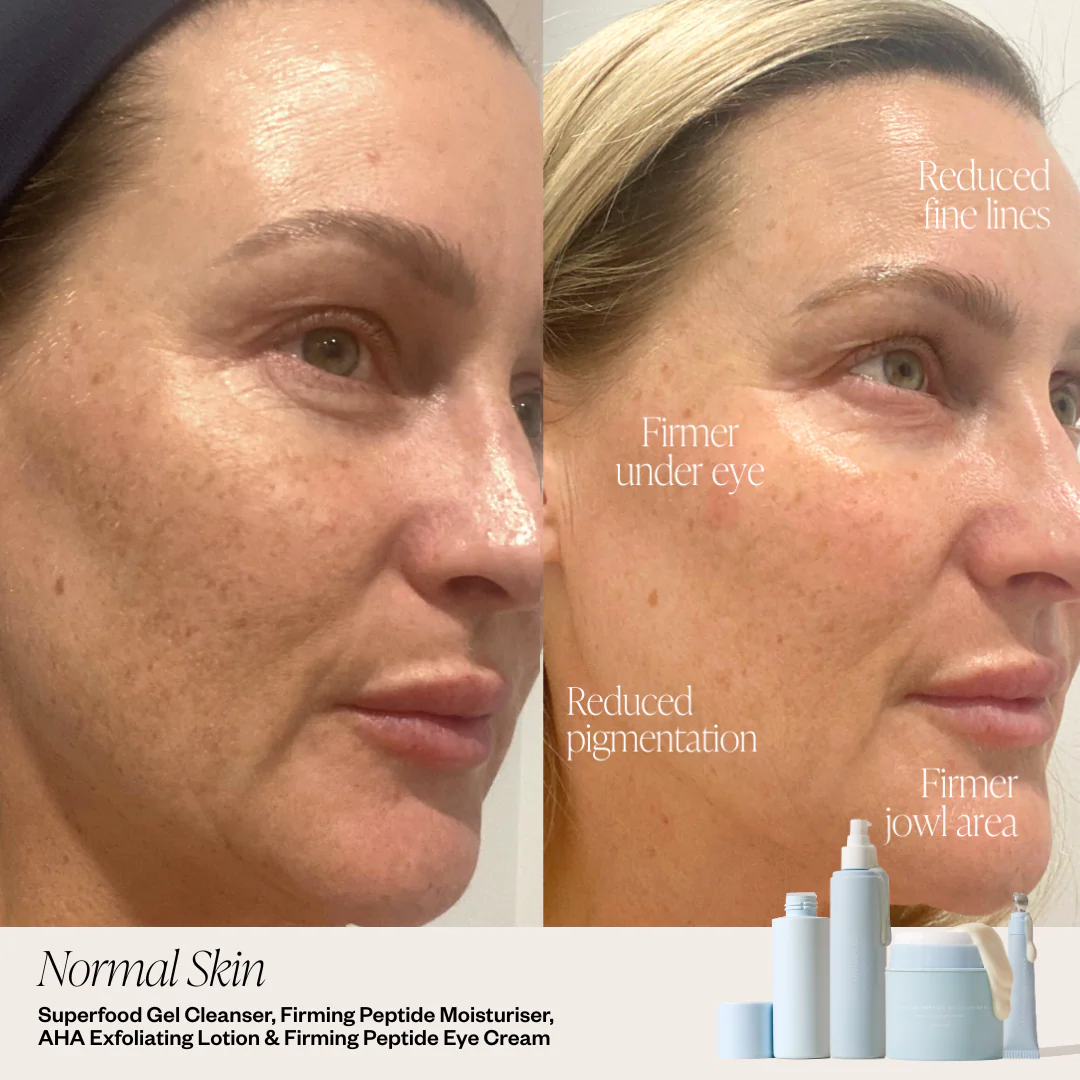 4 Step Skincare System - Image 4