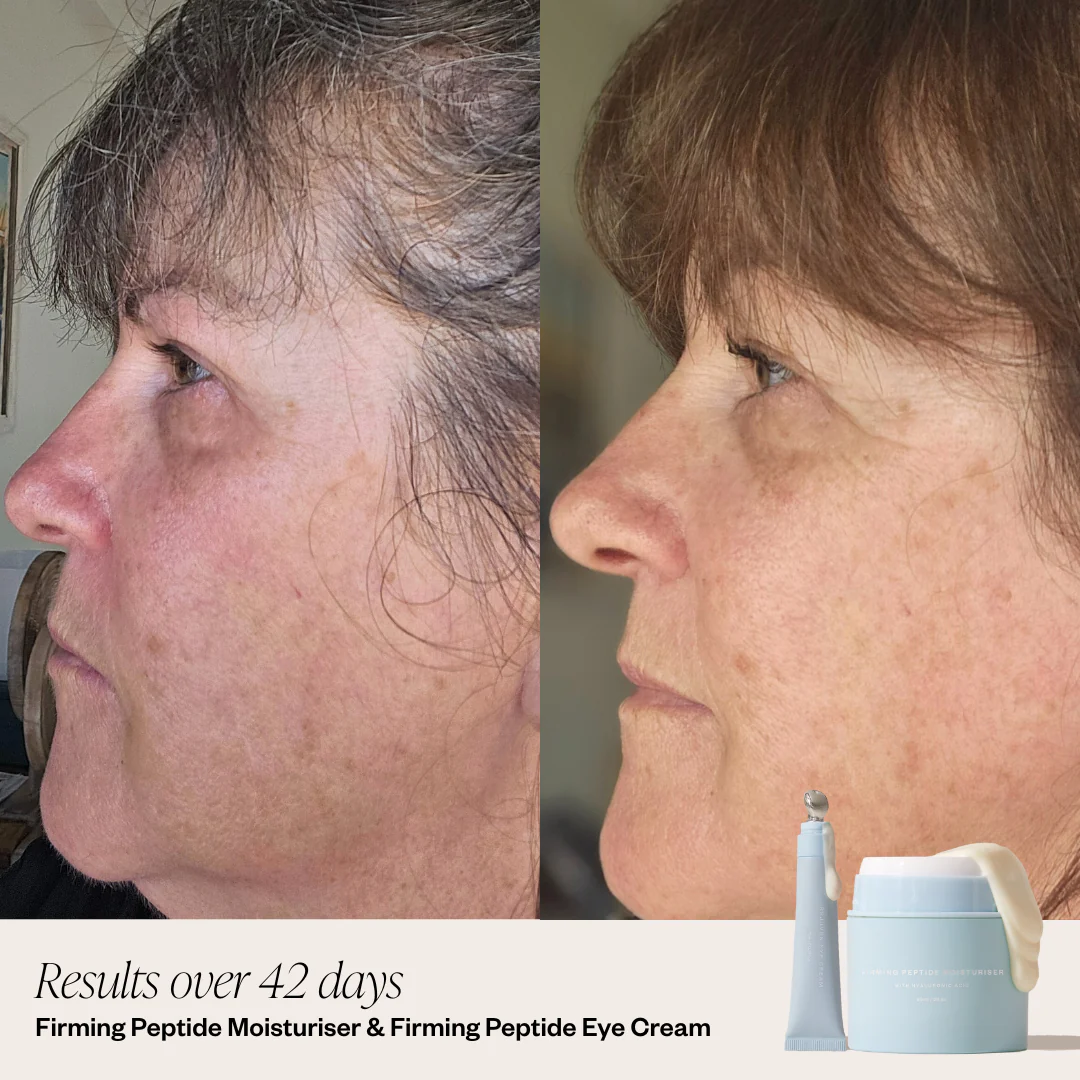 4 Step Skincare System - Image 5