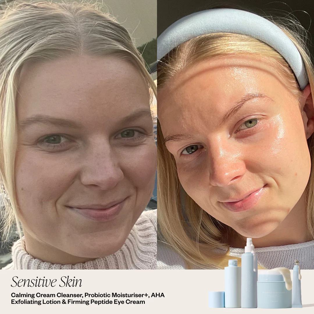 4 Step Skincare System - Image 6