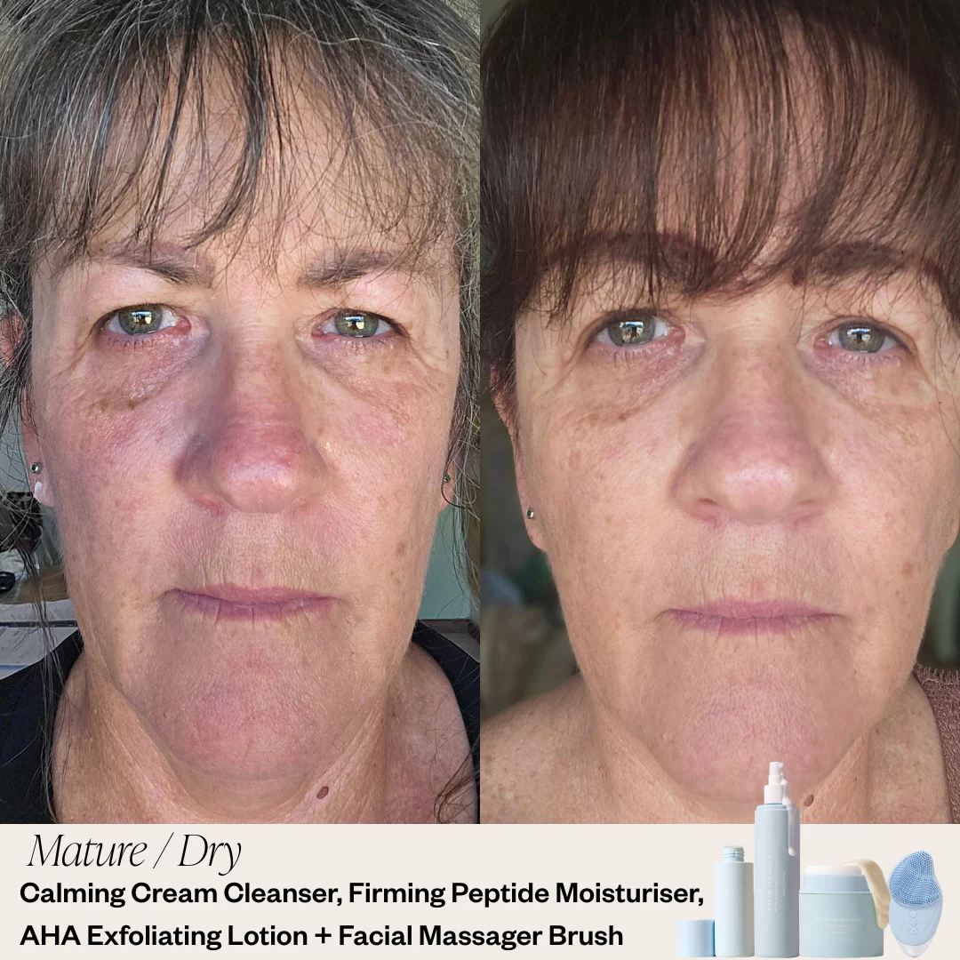 3 Step Skincare System - Image 4