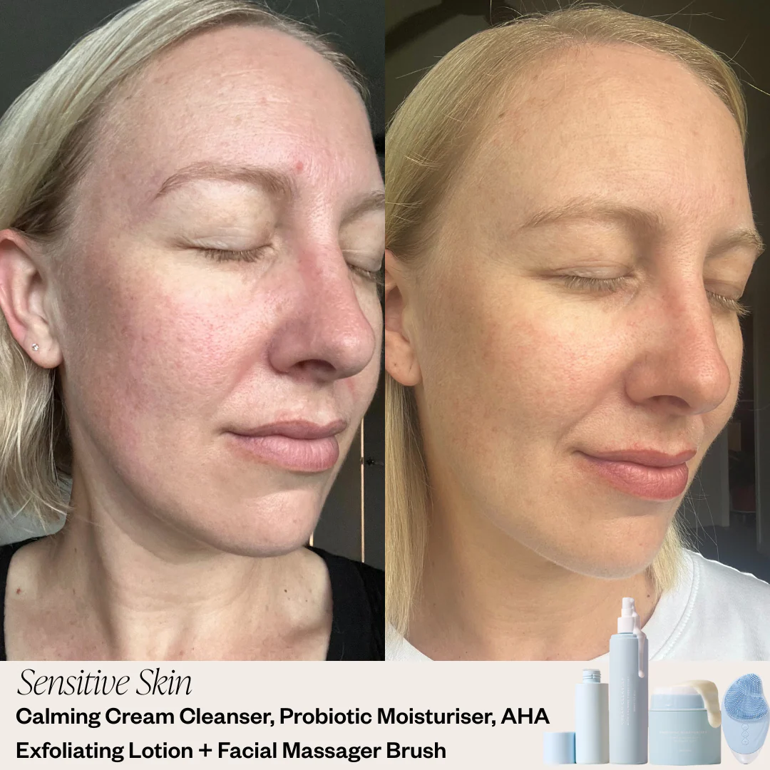 3 Step Skincare System - Image 6