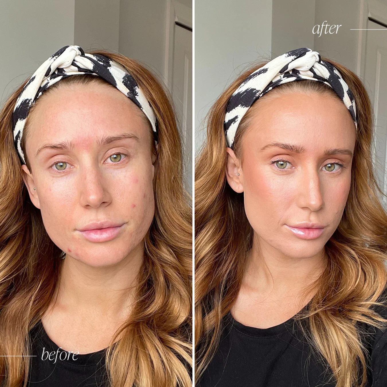 Oily Problematic Skin - Makeup Trial Bundle - Image 4