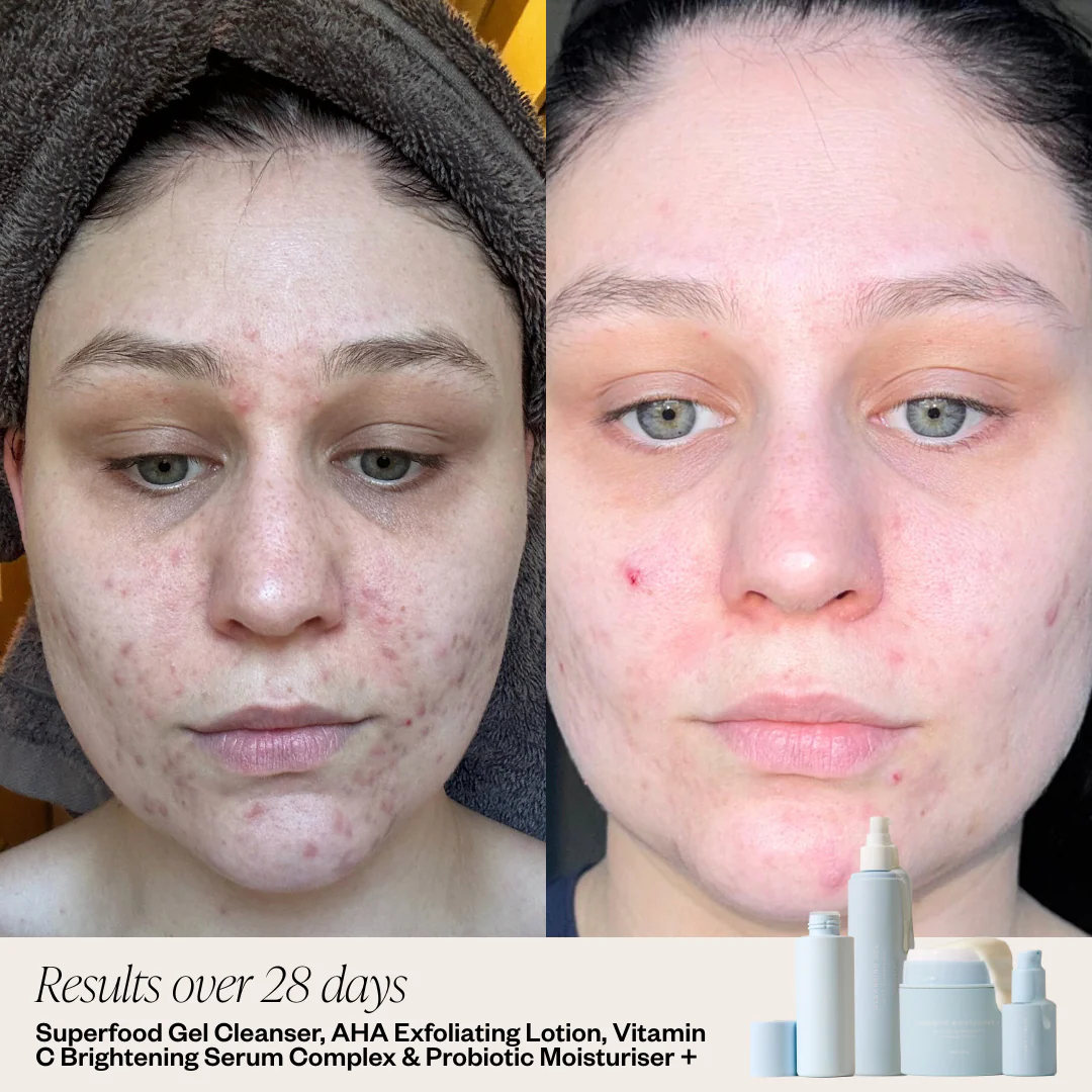 Probiotic Moisturiser + - Image 3