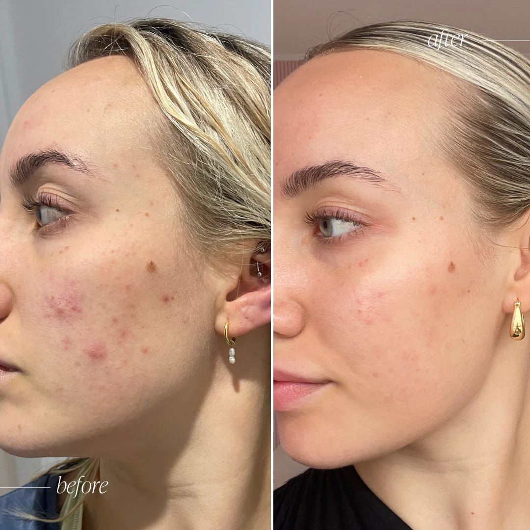Probiotic Moisturiser + - Image 7