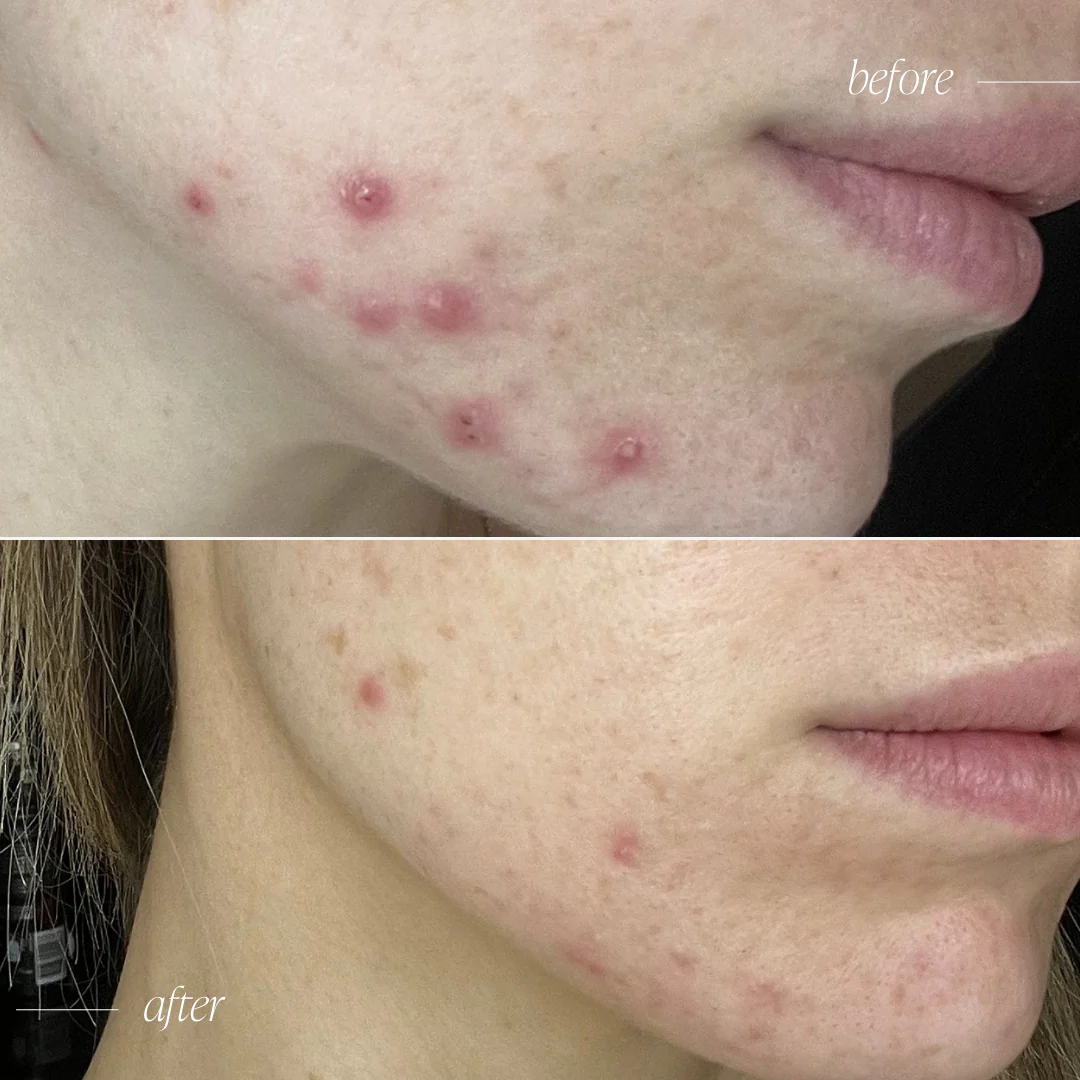 Probiotic Moisturiser + Trial Size - Image 4
