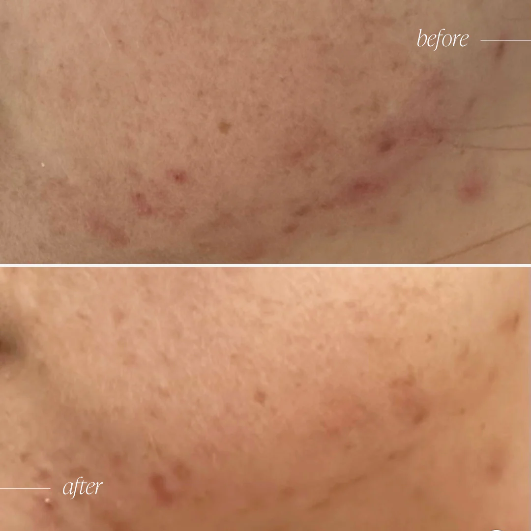 Probiotic Moisturiser + Trial Size - Image 5