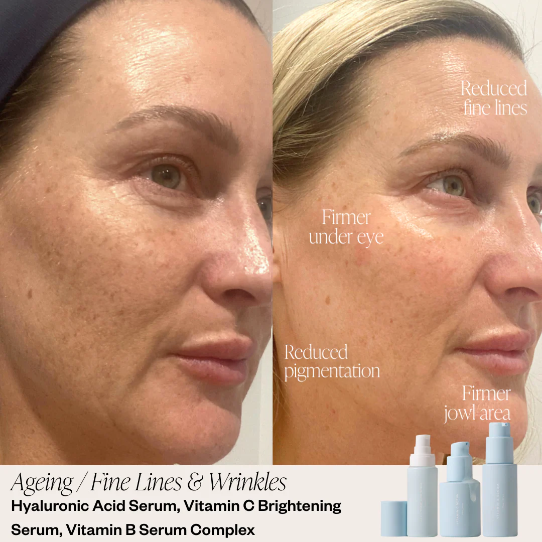 Targeted Serum System - Image 4