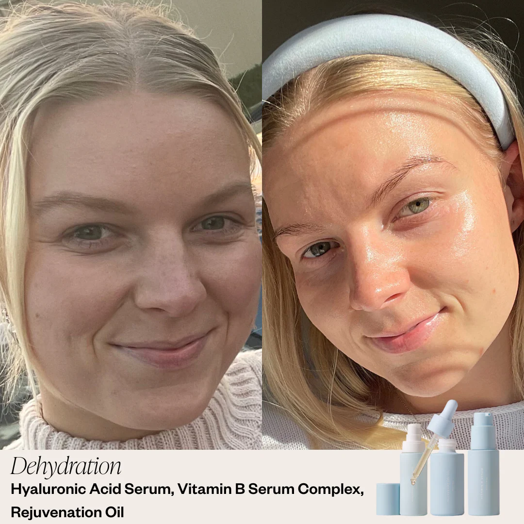 Targeted Serum System - Image 5