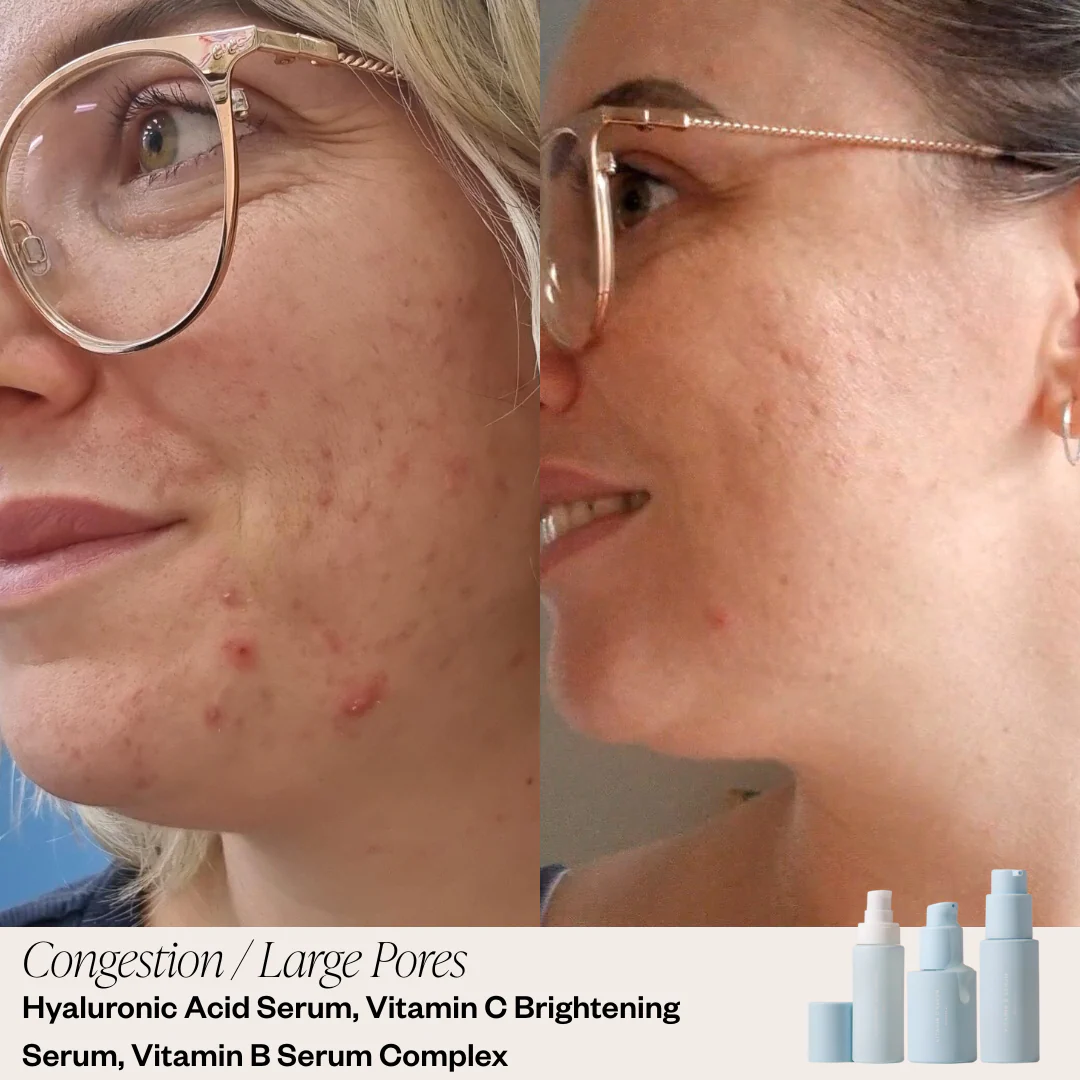 Targeted Serum System - Image 7