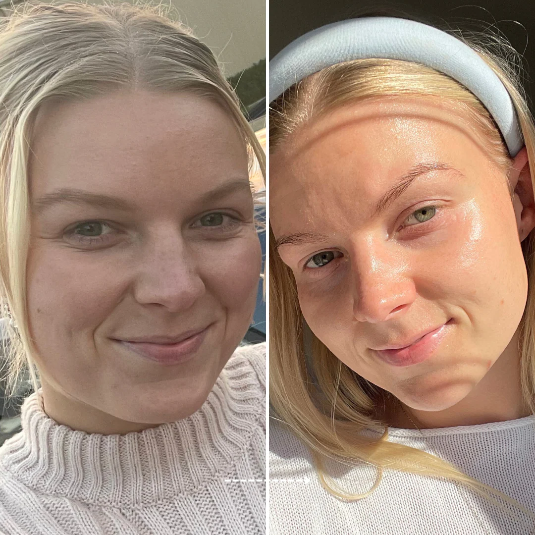 Skincare Try It All Bundle - Trial Size - Image 3
