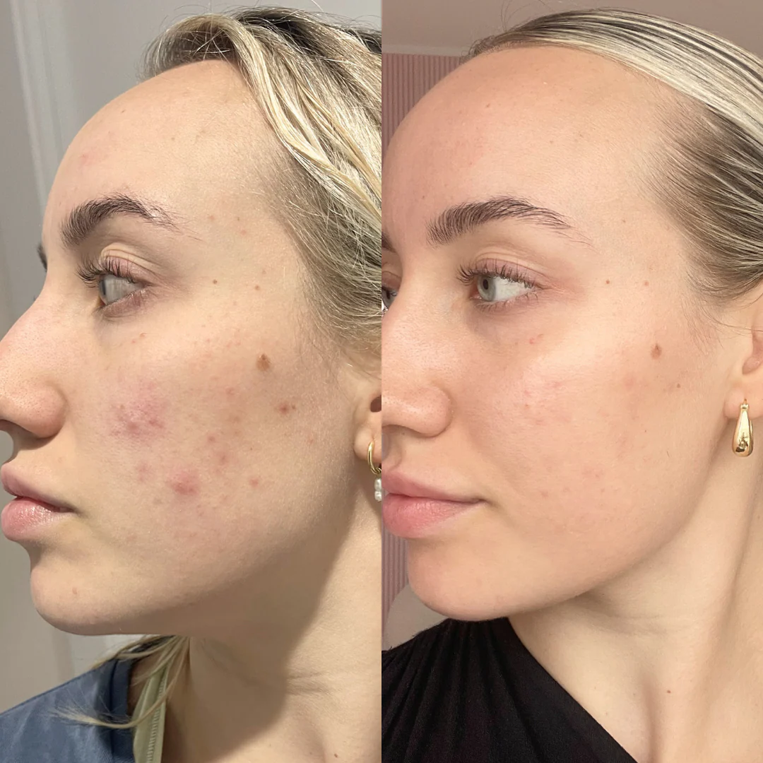 Skincare Try It All Bundle - Trial Size - Image 4