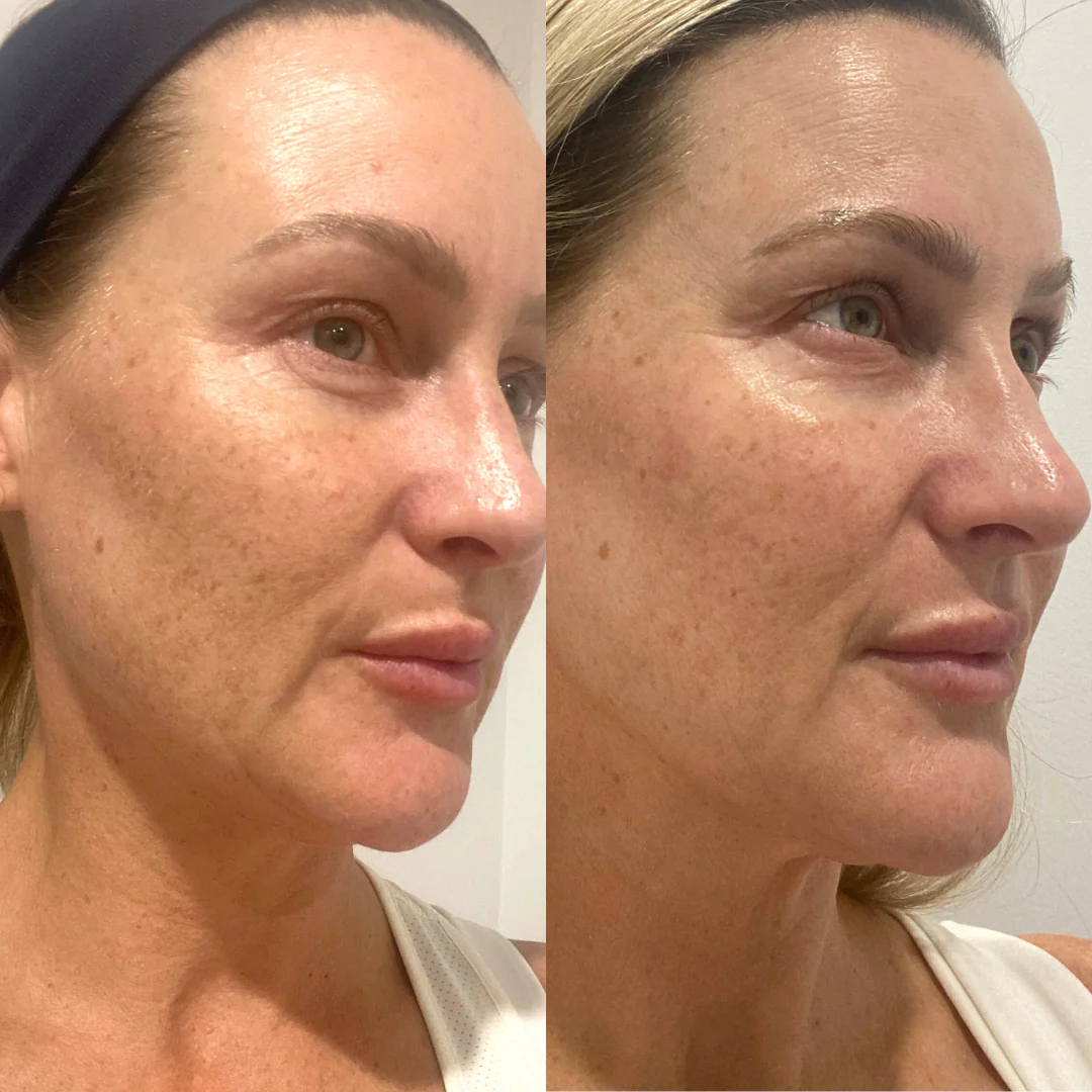 Skincare Try It All Bundle - Trial Size - Image 5