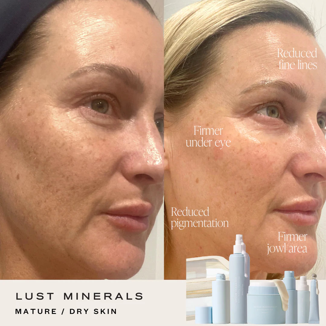 Stacey's Everyday Go-To Skincare System - Image 3
