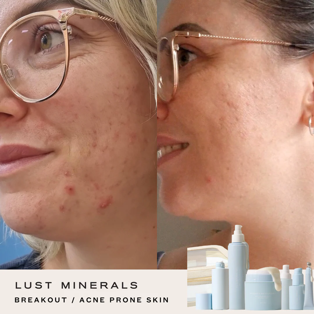 Stacey's Everyday Go-To Skincare System - Image 6