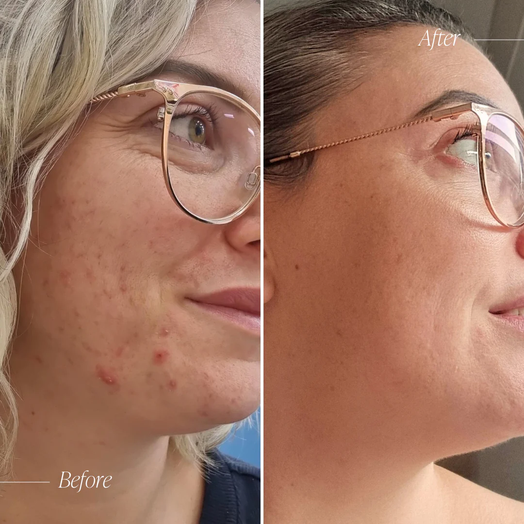 Targeted Skincare Trial System - Image 9