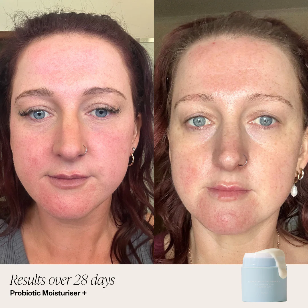 Probiotic Moisturiser + - Image 4