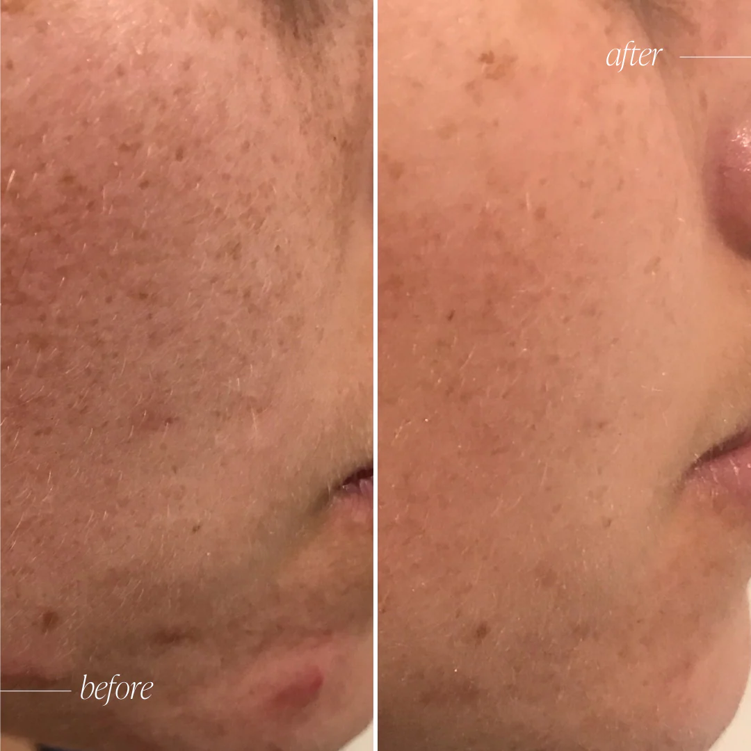 Vitamin C Brightening Serum Complex - Image 3