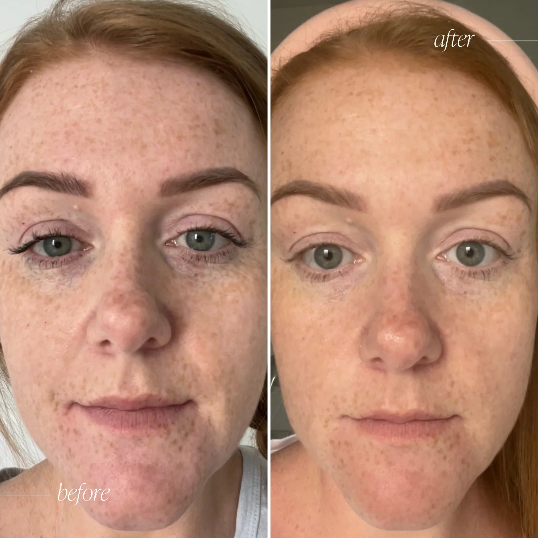 Vitamin C Brightening Serum Complex - Image 4